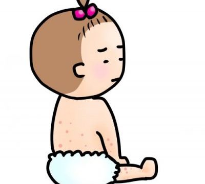 水いぼのイソジン軟膏の効果と効かない塗り方